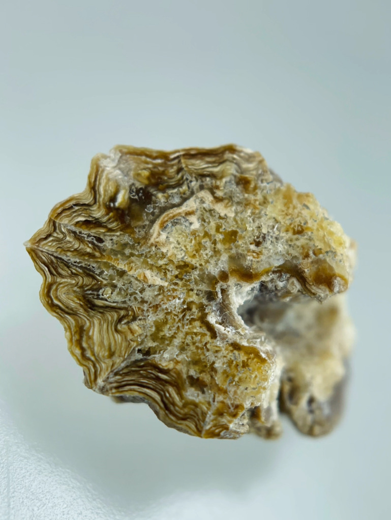 Kidney stone cross-section